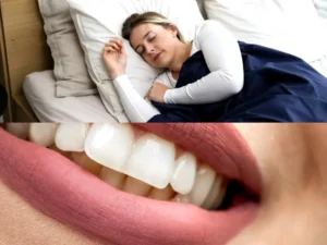 "Femme dormant paisiblement sur le côté, associée à un sourire éclatant en gros plan, illustrant le lien entre sommeil réparateur et santé bucco-dentaire.